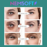 NEMSOFT GÖZ ALTI ONARIM CİHAZI