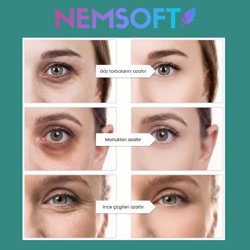 NEMSOFT GÖZ ALTI ONARIM CİHAZI